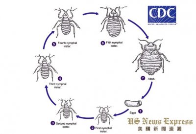 ​床虱来袭 纽约、洛杉矶皆沦陷 出游度假需谨慎